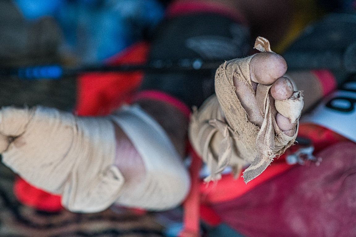 Los pies descalzos de Karim El Hayani tras una etapa del Marathon des Sables. MDS.