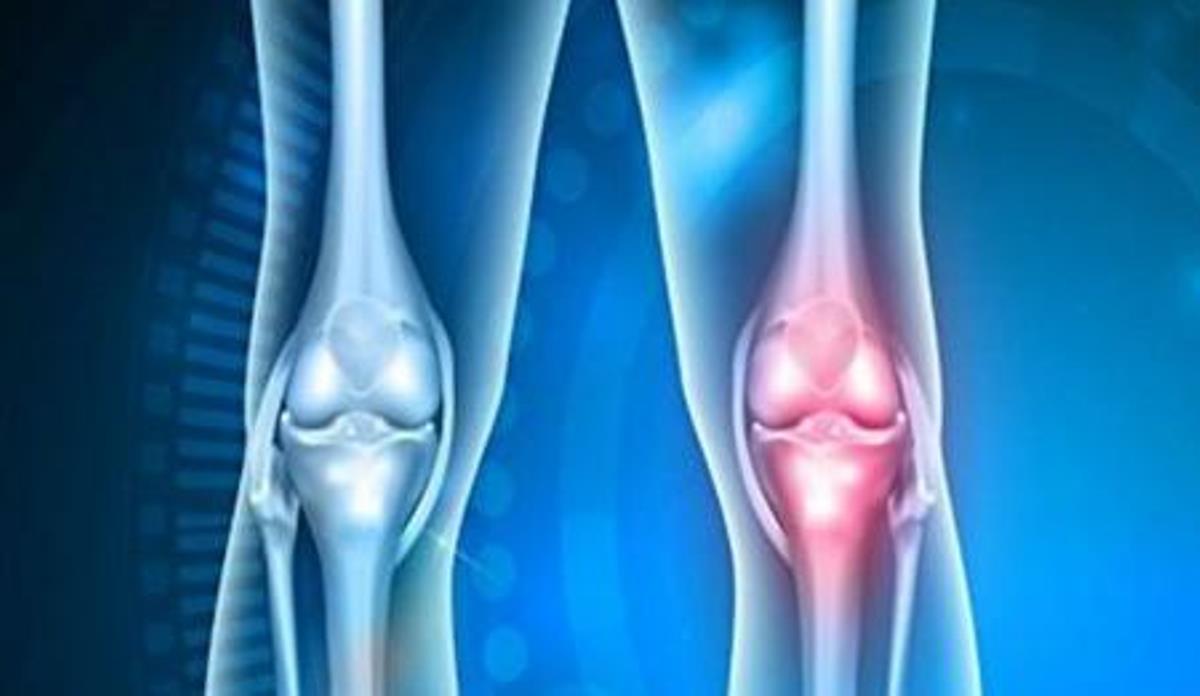 ¿Realmente es útil el colágeno para prevenir y cuidar las articulaciones?