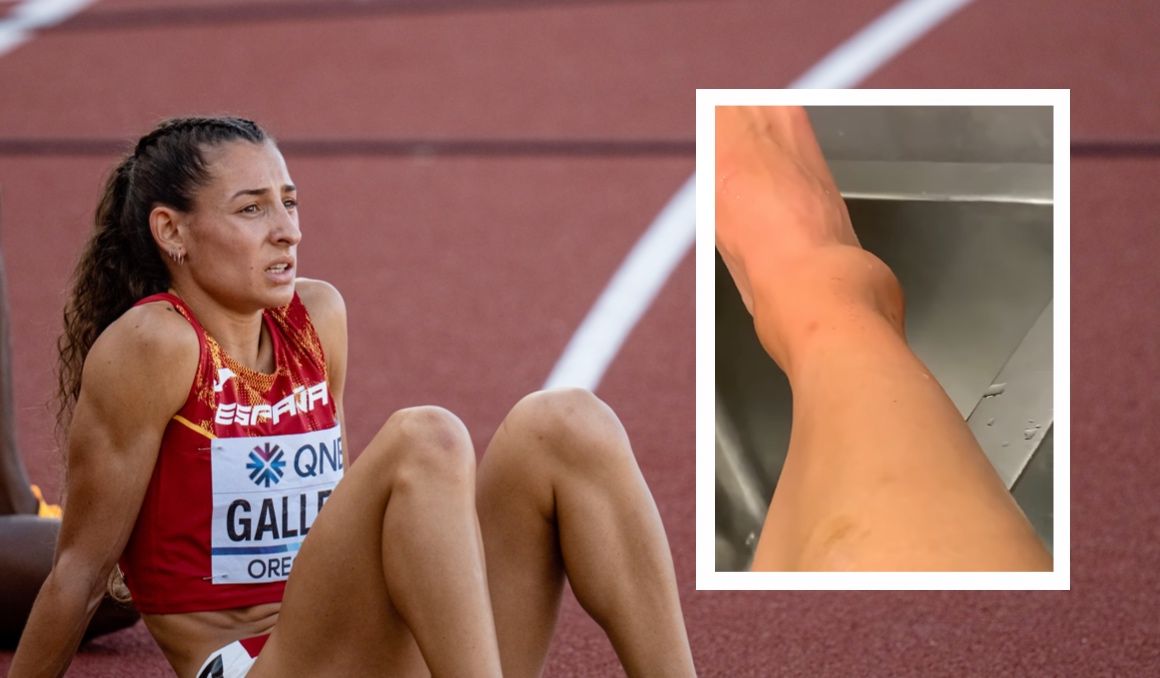 Una imagen de Sara Gallego y, a la derecha, de su tobillo actualmente. SPORTMEDIA.