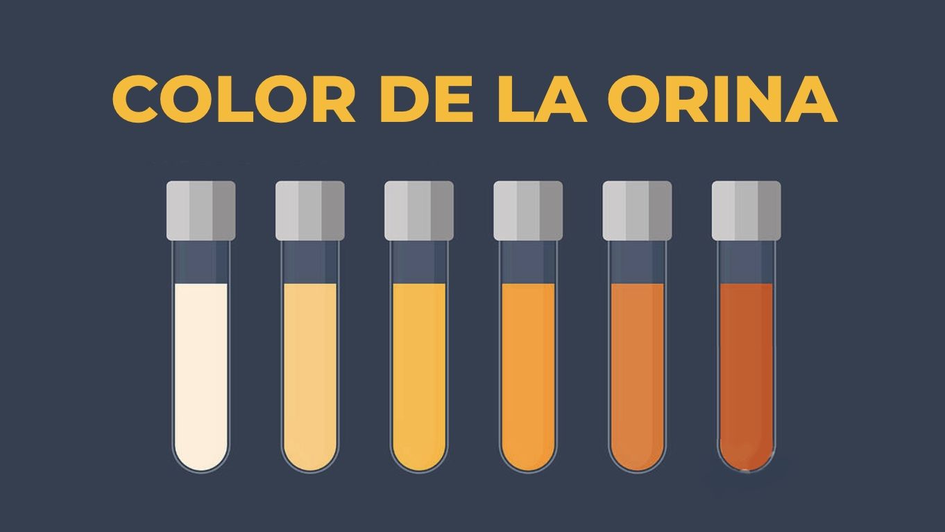 ¿Qué significa el color de la orina?