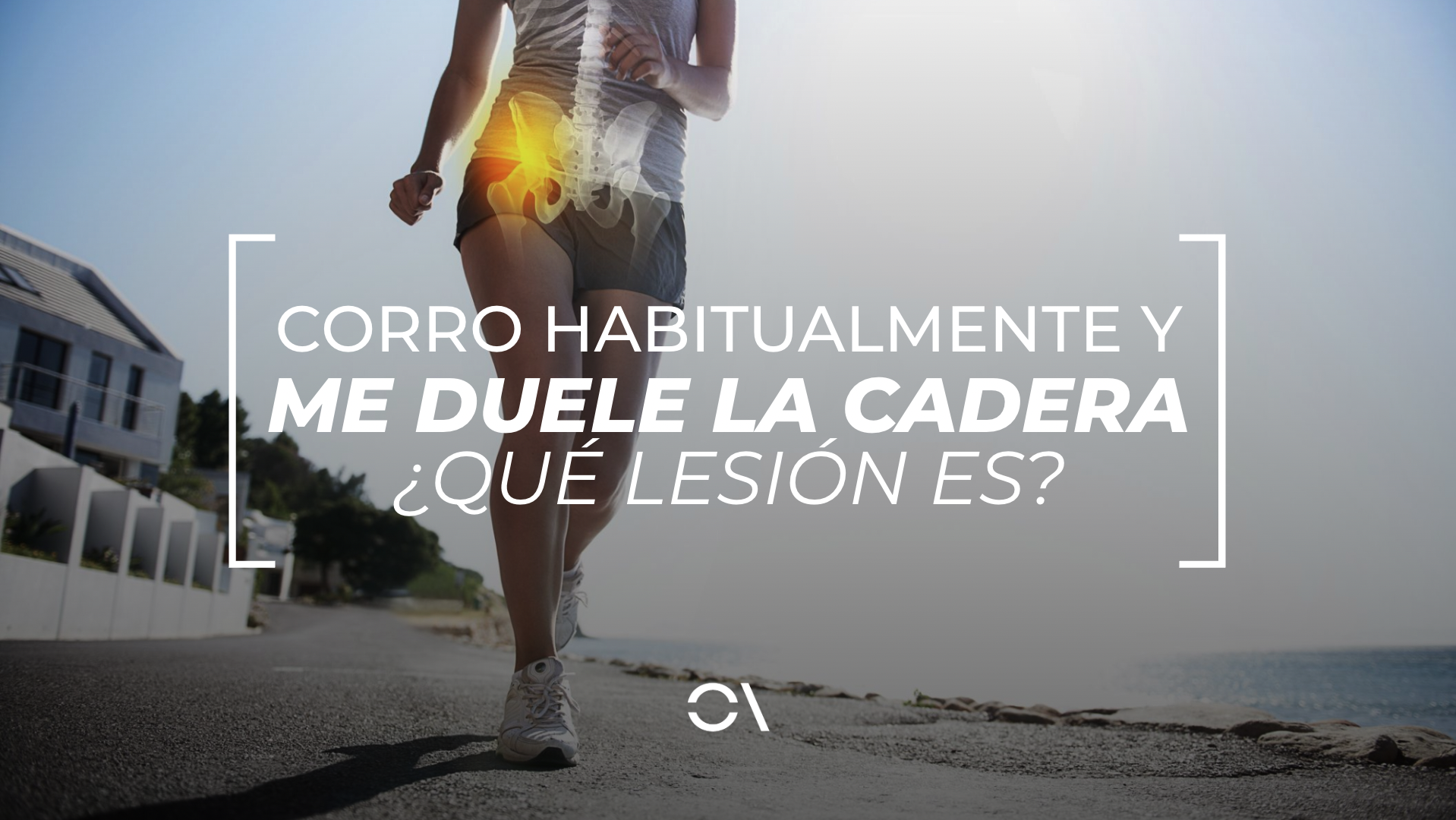 "Corro y me duele la cadera"; ¿qué lesión es?