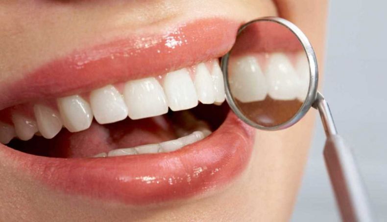 caries 2 790x454