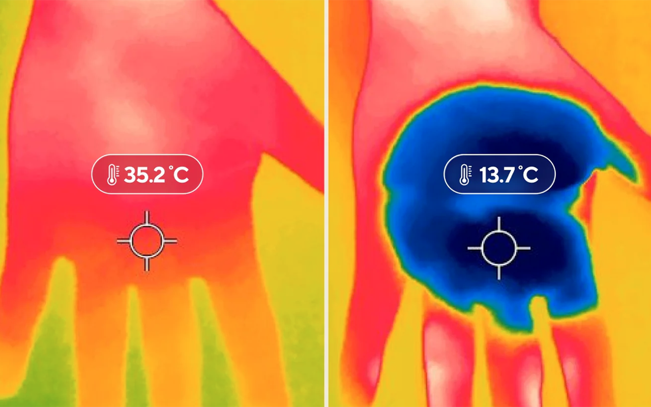 CryoTherm Palm