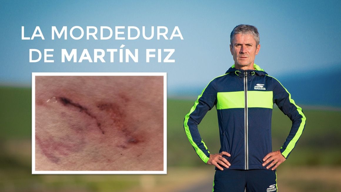 La mordedura de Martín Fiz | soycorredor.es