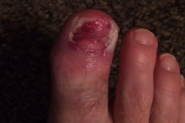 Los pies más feos que jamás has visto