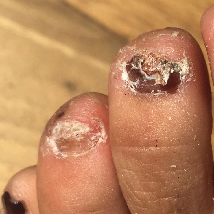 Los pies más feos que jamás has visto