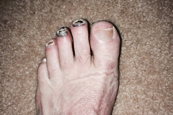 Los pies más feos que jamás has visto