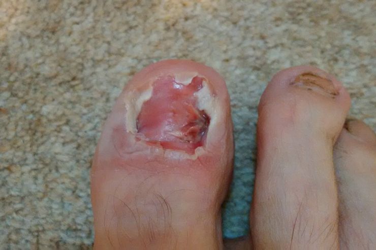 Los pies más feos que jamás has visto