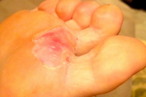 Los pies más feos que jamás has visto