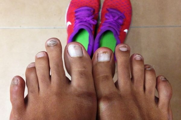 Los pies más feos que jamás has visto