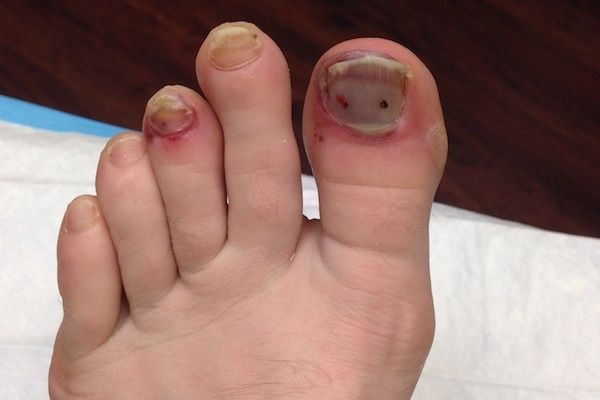 Los pies más feos que jamás has visto