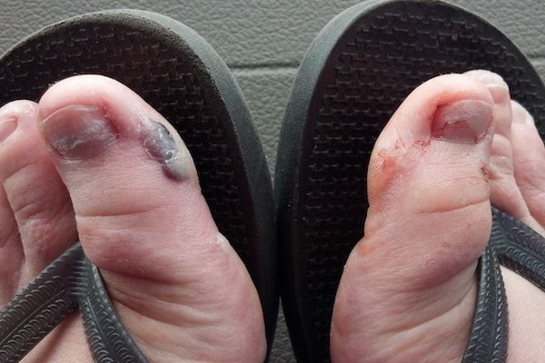 Los pies más feos que jamás has visto