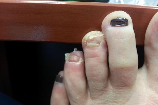 Los pies más feos que jamás has visto