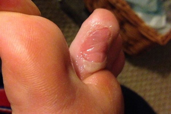 Los pies más feos que jamás has visto