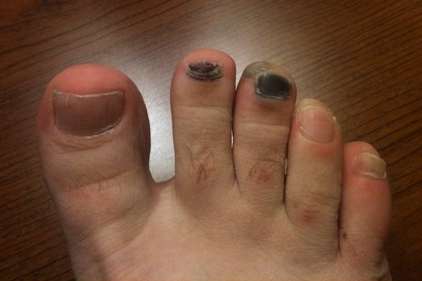 Los pies más feos que jamás has visto