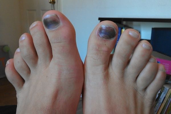 Los pies más feos que jamás has visto