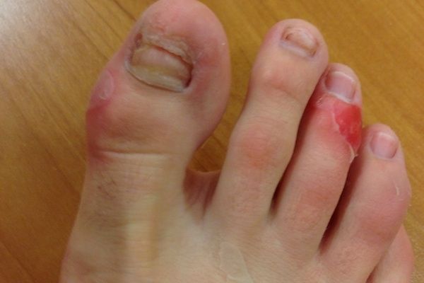 Los pies más feos que jamás has visto