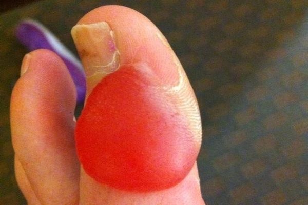 Los pies más feos que jamás has visto
