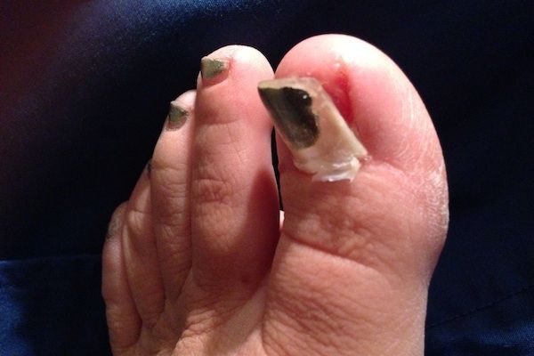 Los pies más feos que jamás has visto