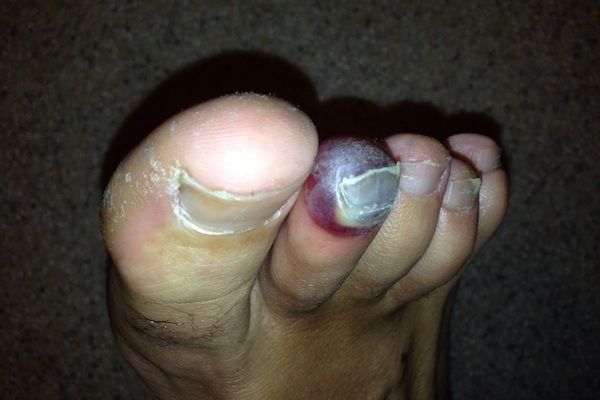 Los pies más feos que jamás has visto