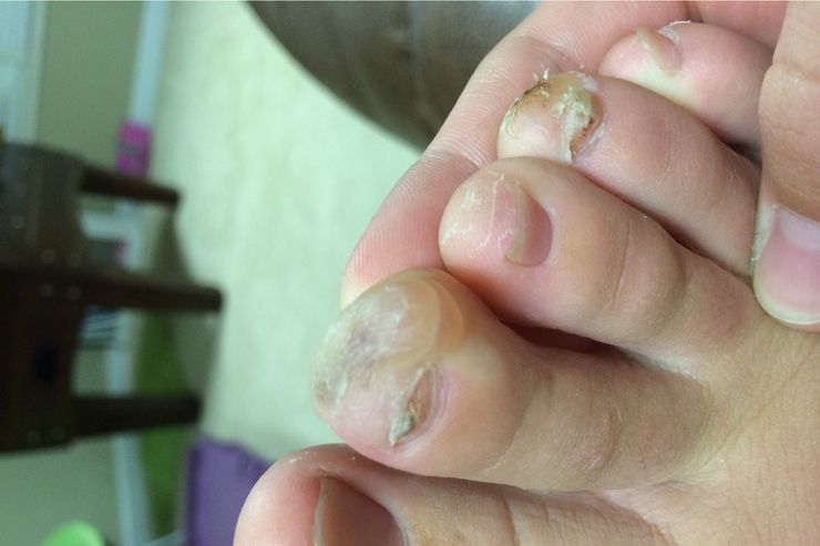 Los pies más feos que jamás has visto