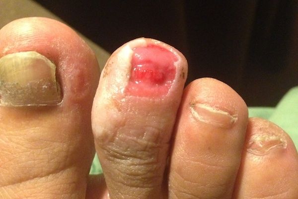 Los pies más feos que jamás has visto