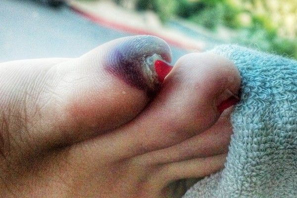 Los pies más feos que jamás has visto
