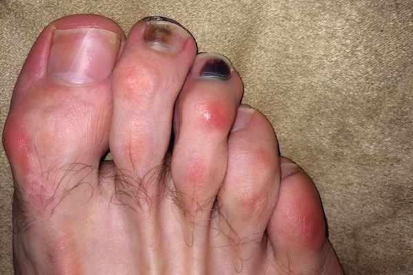 Los pies más feos que jamás has visto