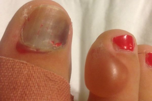 Los pies más feos que jamás has visto