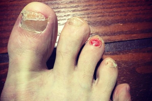 Los pies más feos que jamás has visto