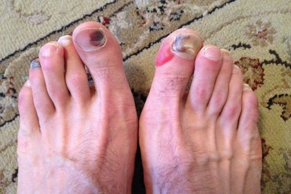 Los pies más feos que jamás has visto