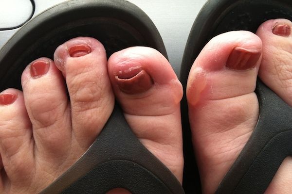 Los pies más feos que jamás has visto